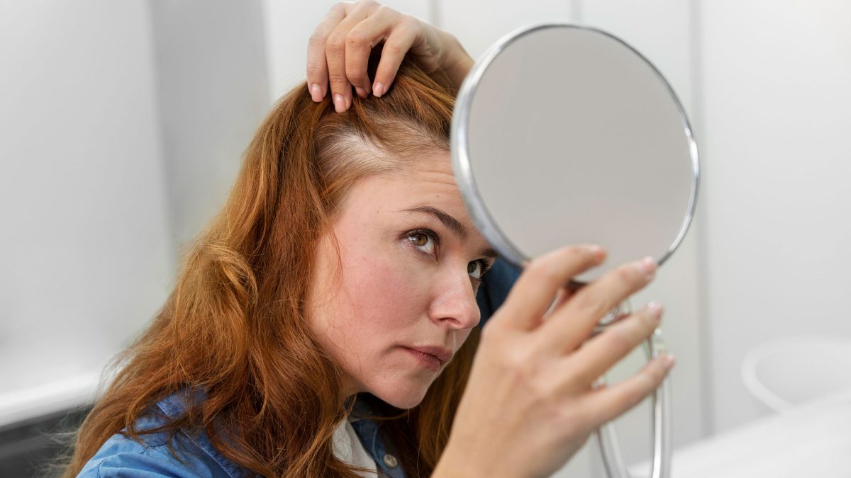 علت ریزش مو چیست و چند راه درمان برای آن